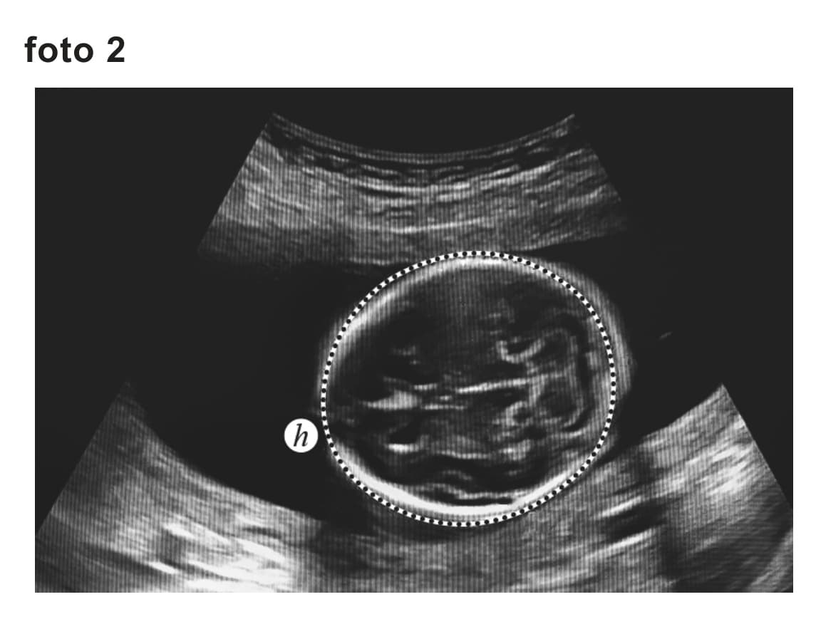 Figuur 2 bij vraag 3